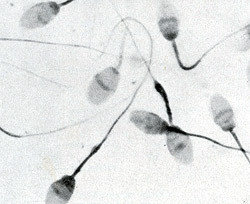 Разработана искуственная человеческая сперма  
