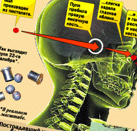 Итальянец чихнул пулей