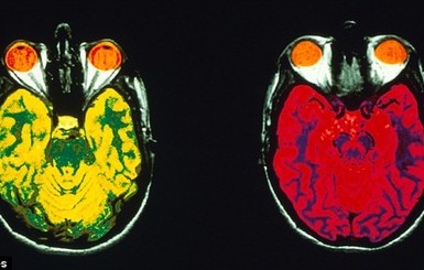 Исследователи обнаружили в мозге людей 