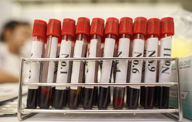 Неизвестные украли образцы крови пациентов, зараженных Эболой