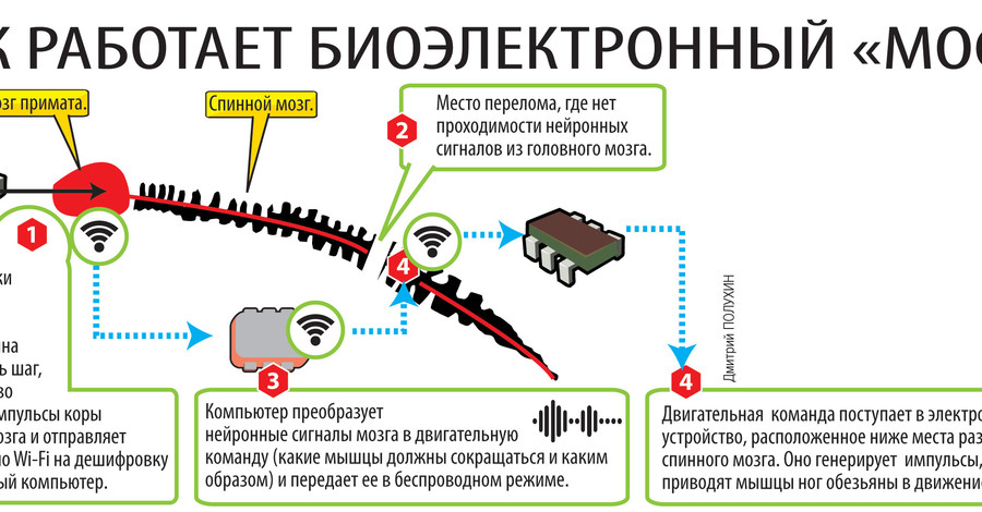 Трансплантация головы отменяется?