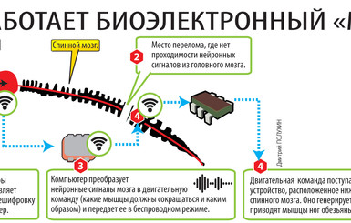 Трансплантация головы отменяется?