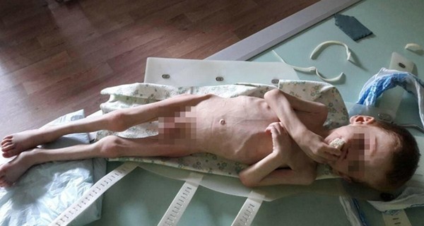 На Кировоградщине начался суд над депутатом, заморившим голодом сына