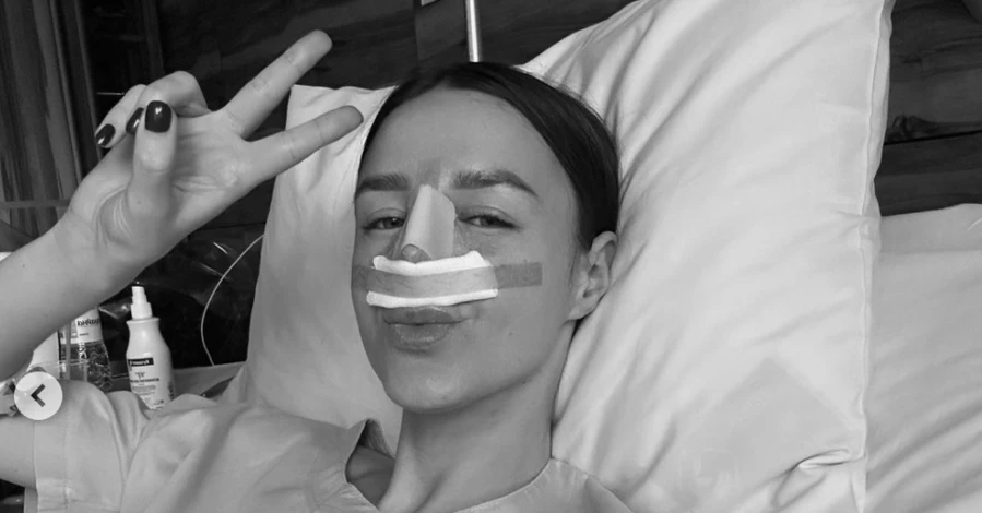 Блогерка Аліна Френдій зробила пластику носа і відповіла незадоволеним підписникам