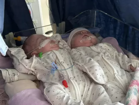 В Охматдете спасают двойняшек, которые родились с весом 720 и 730 граммов