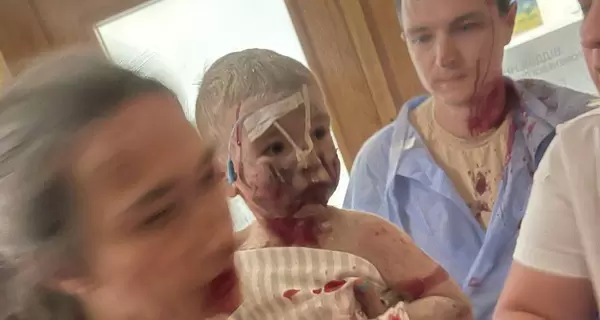 Ракетная атака на Киев - повреждены детская больница 